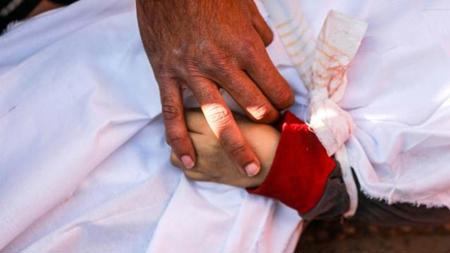 منظمة الصحة العالمية:" غزة أصبحت منطقة قتل"