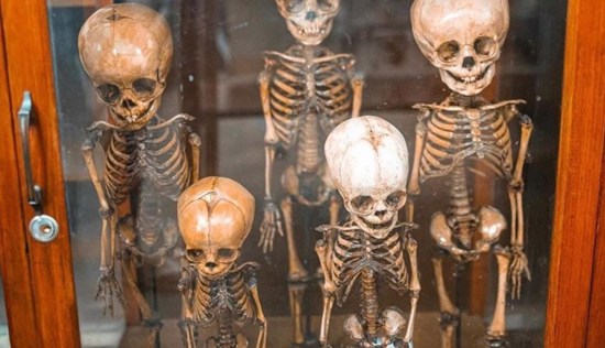 شاب أمريكي يفتح محلا لبيع عظام وجماجم بشرية حقيقية