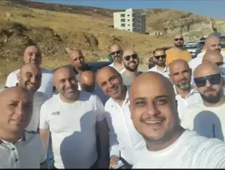 الصلعان في الأردن يثيرون ضجة واسعة