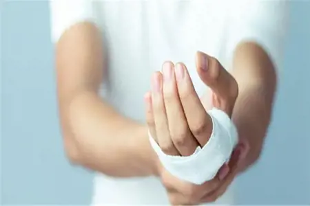 آلاف الإصابات جراء ذبح الأضاحي في تركيا.. وزير الصحة يكشف العدد الصادم