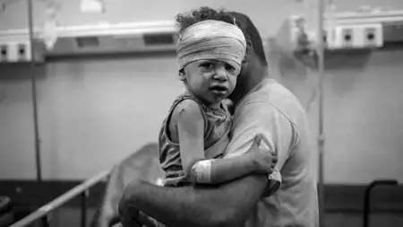 الأمم المتحدة:" تنفيذ أمر إخلاء المستشفيات في غزة سيكون بمثابة حكم بالإعدام"