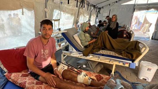 ما هي أكثر الإصابات التي يصاب بها الفلسطينيين بسبب الحرب في غزة؟
