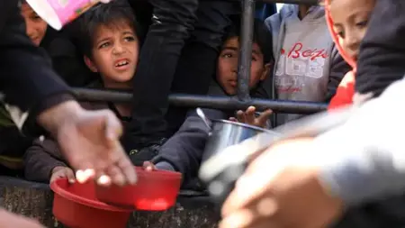 منظمة الصحة العالمية:" أطفال غزة يموتون جوعًا" منظمة الصحة العالمية:" أطفال غزة يموتون جوعًا"