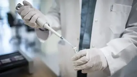 ارتفاع عدد مراكز الفحص الطوعي لفيروس نقص المناعة البشرية/الإيدز  في تركيا