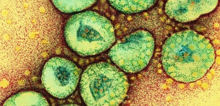 الولايات المتحدة تعلن العثور على فيروس قاتل يختبئ تحت الأرض
