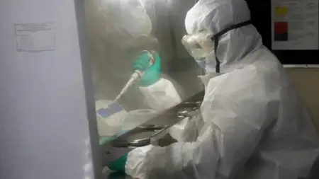 الولايات المتحدة تحذر من بكتيريا الشيغيلة المقاومة للأدوية في البلاد