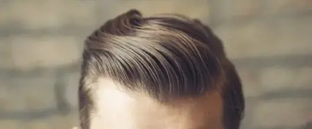 كيف تربع قطاع زراعة الشعر على عرش السياحة العلاجية عالمياً؟