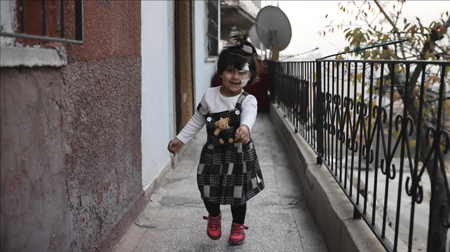 طفلة سورية تستعيد بصرها في تركيا