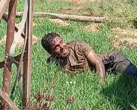 هرب مواطن سوري مصاب بداء الكلب من الحجر في شانلي أورفا