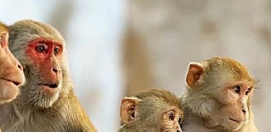 وزارة الصحة السعودية تعلن خلو المملكة من "جدري القرود"