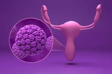 دراسة: أطعمةٌ غنية بمضادات الأكسدة قد تقلّل خطر الإصابة بسرطان عنق الرحم
