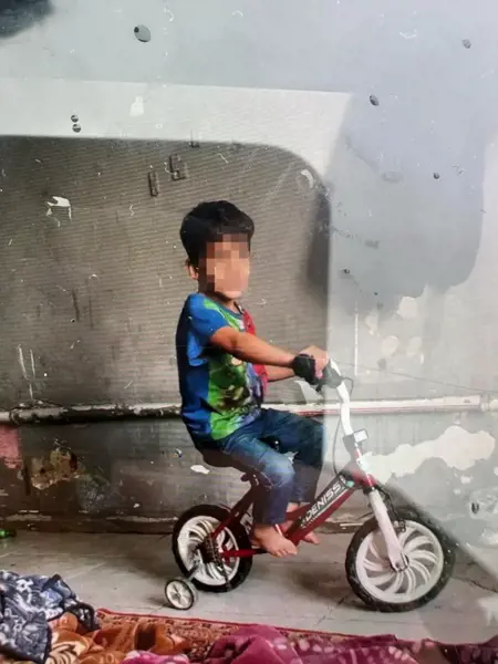 إصابة طفل بجروح خطيرة بسبب الكلاب الضالة في يالوفا