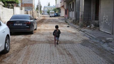 الأمل يعود لطفل سوري "فقد ساقه" في ولاية ماردين