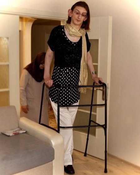 التركية رُميساء تدخل موسوعة "غينيس" كأطول امرأة في العالم