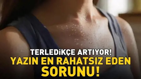 الحر والرطوبة والتعرق الزائد.. كيف تحمي بشرتك من الإسفنجية في الصيف