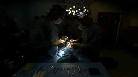 إزالة دودة حية بطول 8 سم من دماغ امرأة في أستراليا