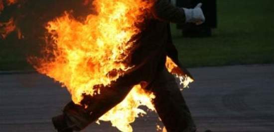 كويتي يضرم النار في زوجته بسبب خلاف عائلي