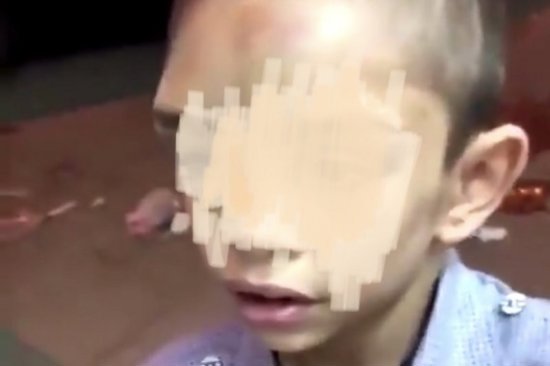 أب سوري يعذب طفله وحملة على السوشيال ميديا لحمايته