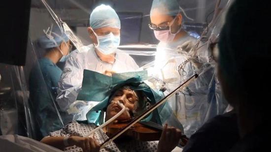 إيقاظ مريضة أجنبية أثناء جراحة في الدماغ لتعزف على الكمان
