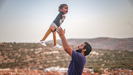 تركيا تعيد الحياة للطفل محمد السوري
